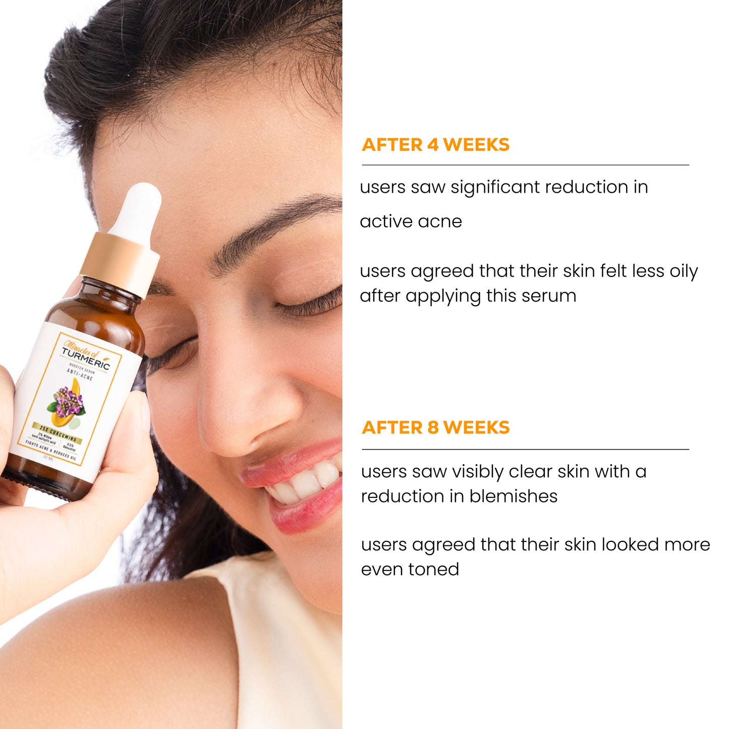 Anti-Acne clarifying serum