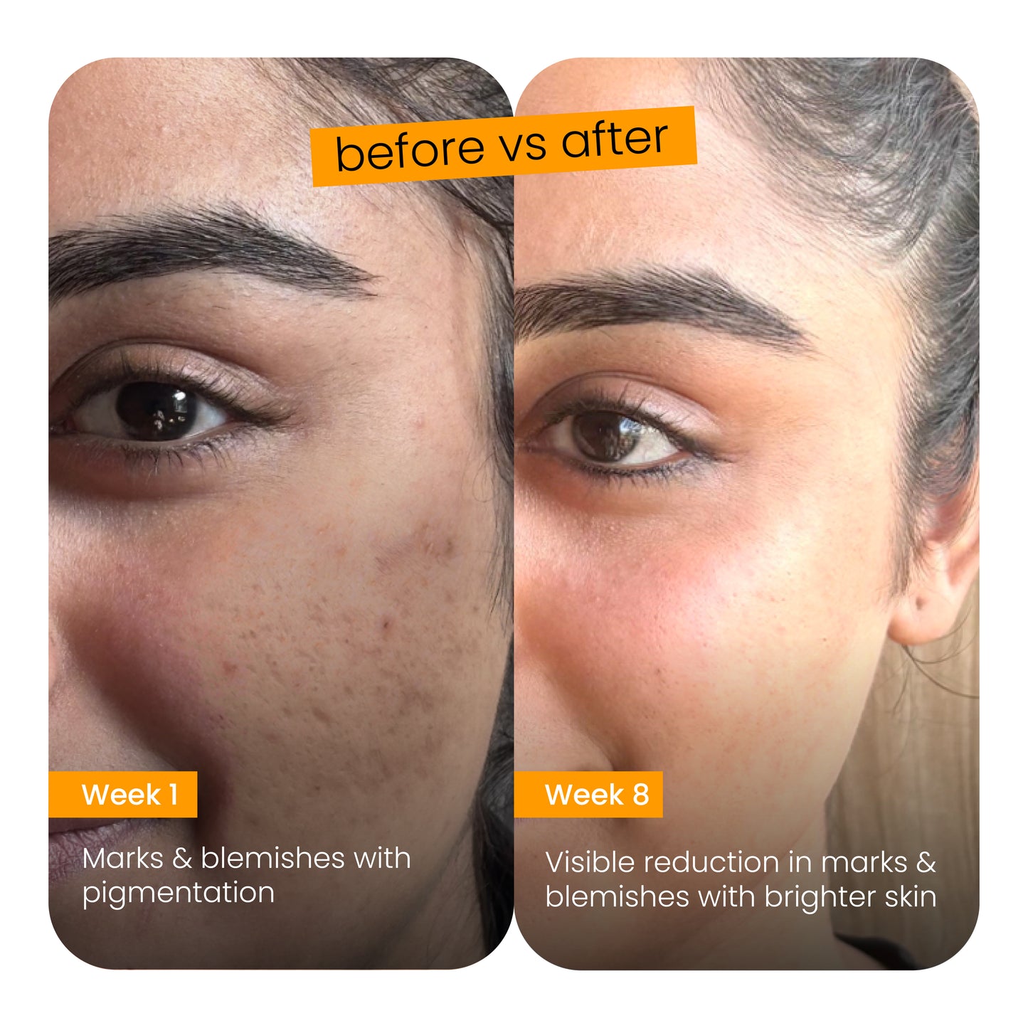 Marks & blemish reduction serum