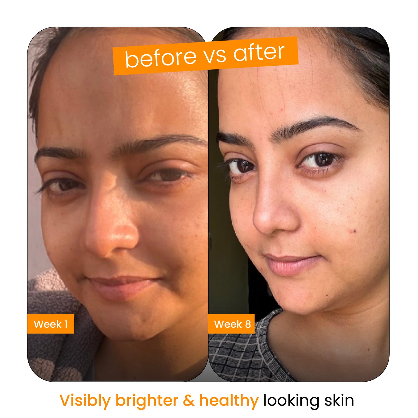 Turmeric Latte Facewash