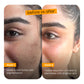 Marks & blemish reduction serum