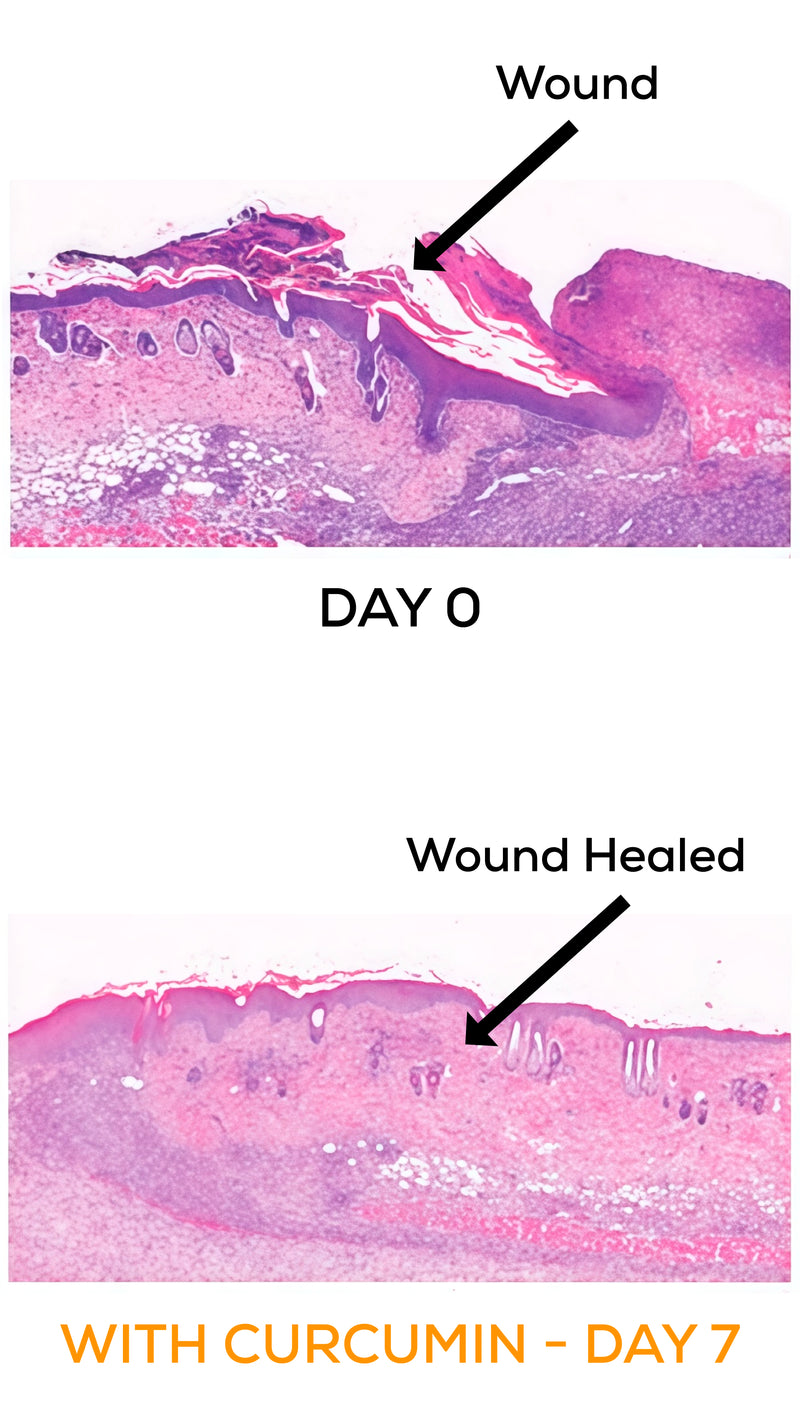 Curcumin effects on