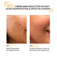 Marks & blemish reduction serum