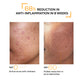 Anti-Acne clarifying serum