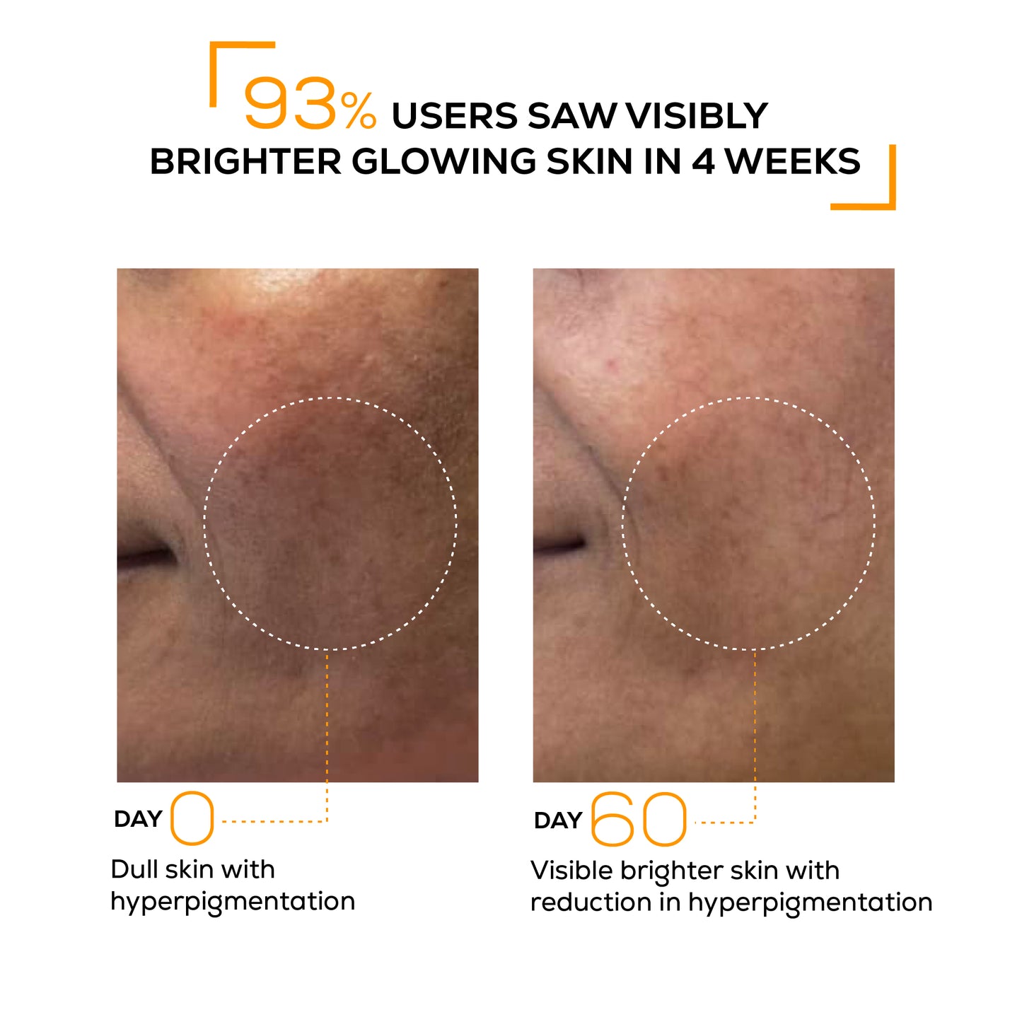 Super booster brightening serum