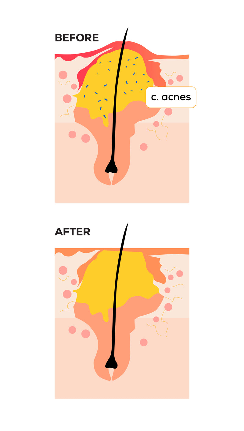 Curcumin as an