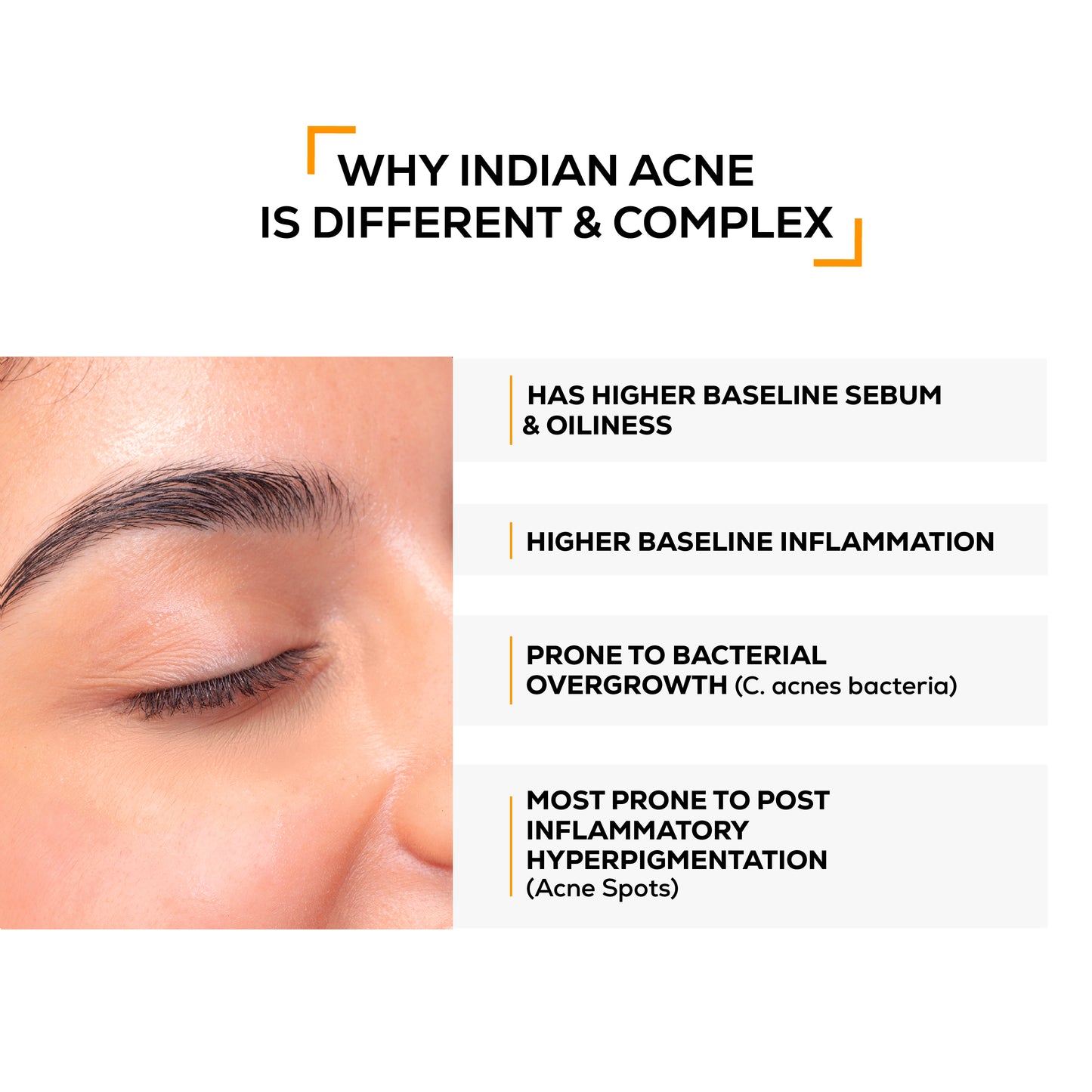 Anti-acne clarifying facewash