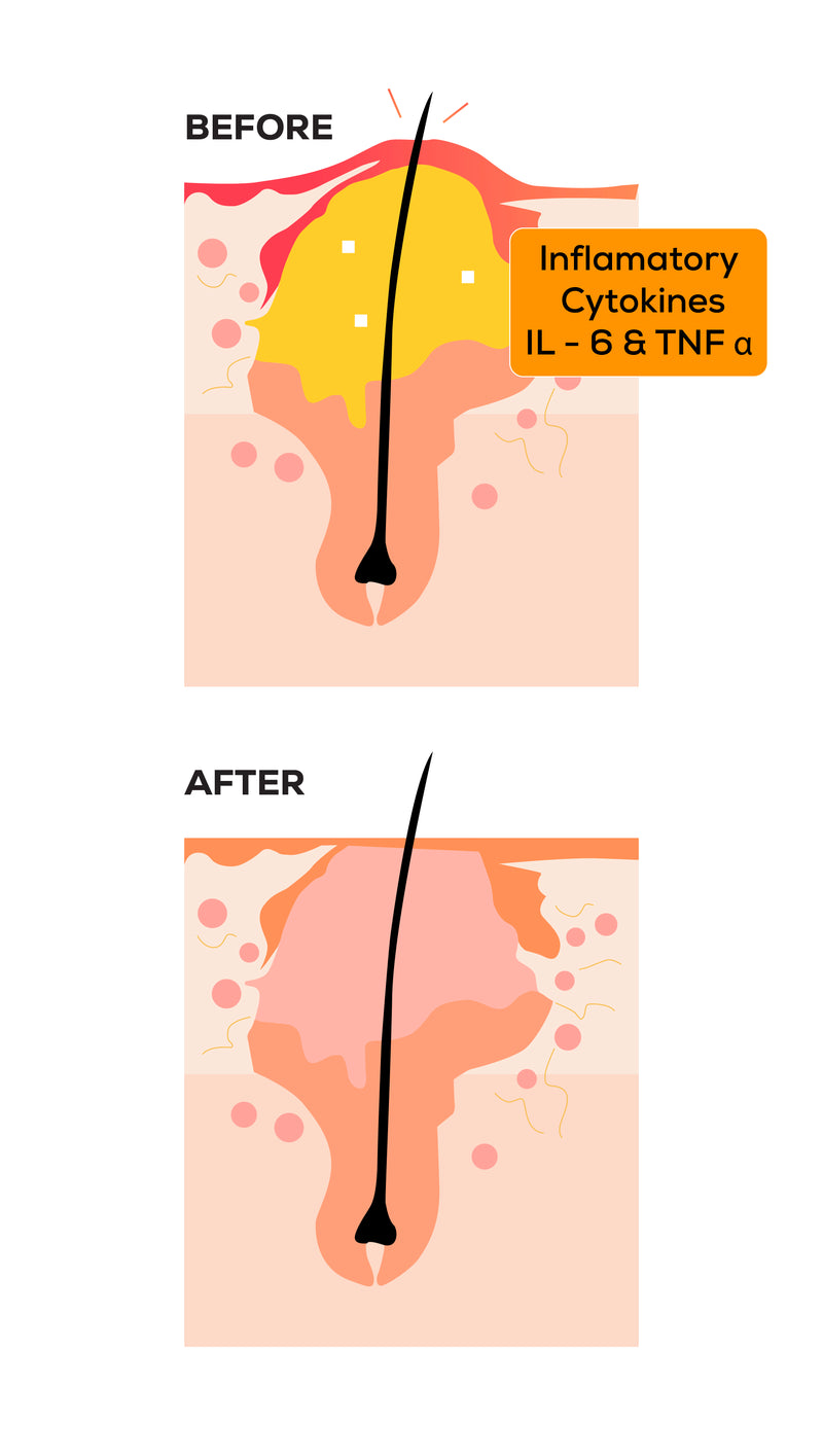 Curcumin effects on