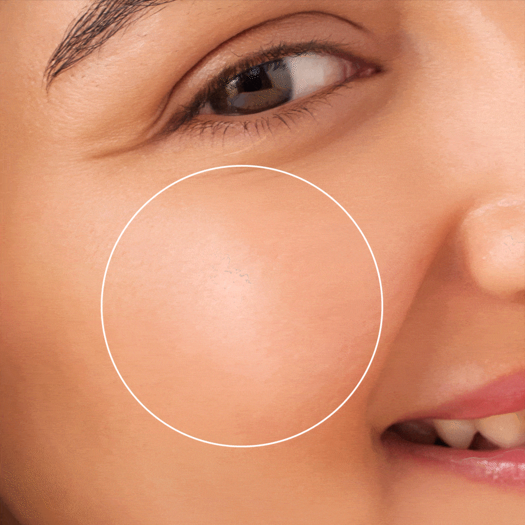 Anti-acne clarifying facewash