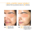 Pigmentation Reduction Serum
