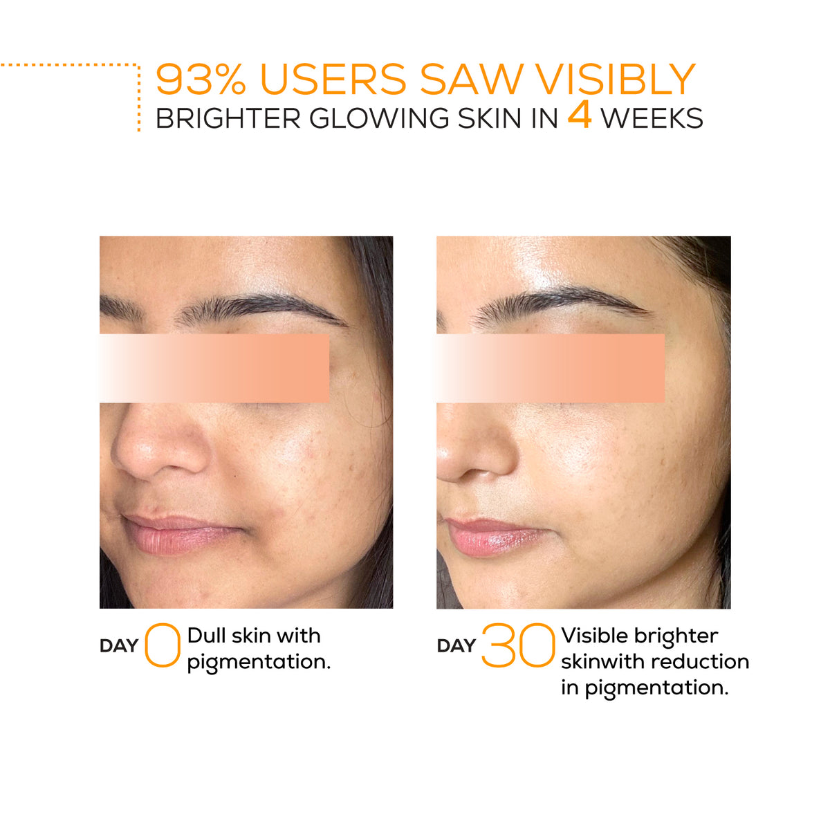 Pigmentation Reduction Serum