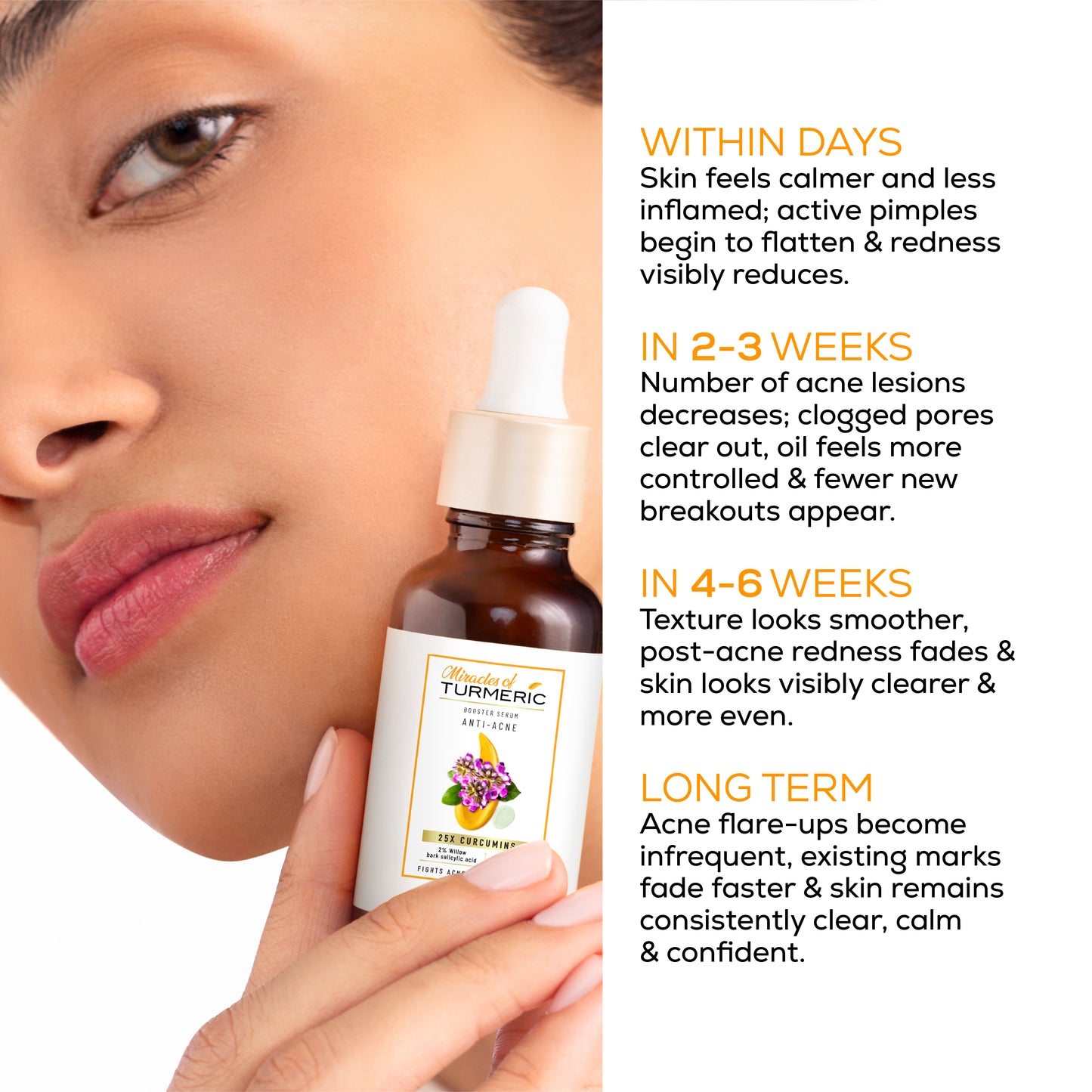 Anti-Acne clarifying serum