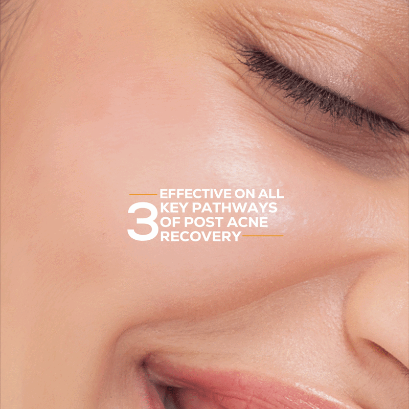 Marks & blemish reduction serum