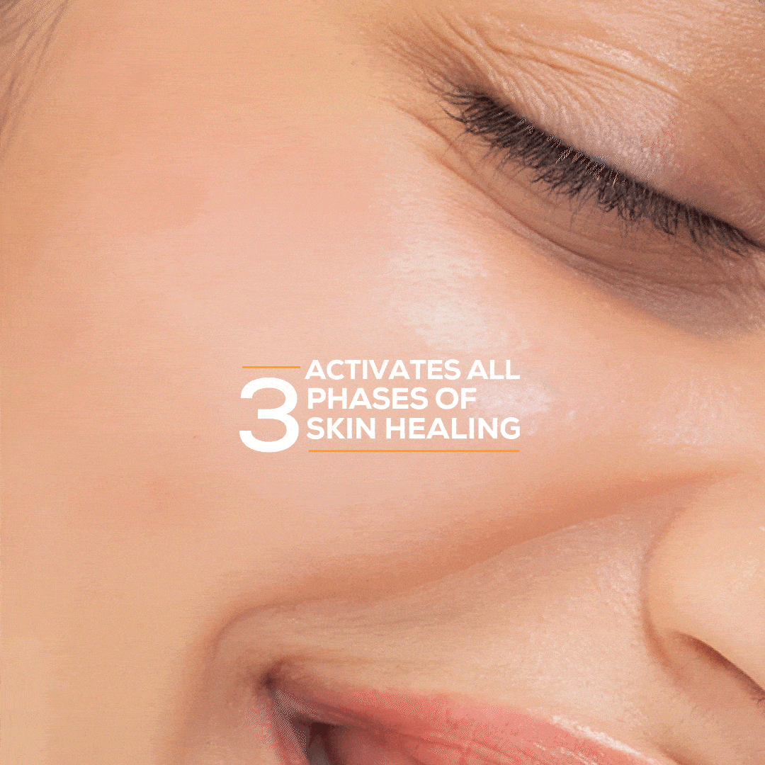 Marks & blemish reduction serum