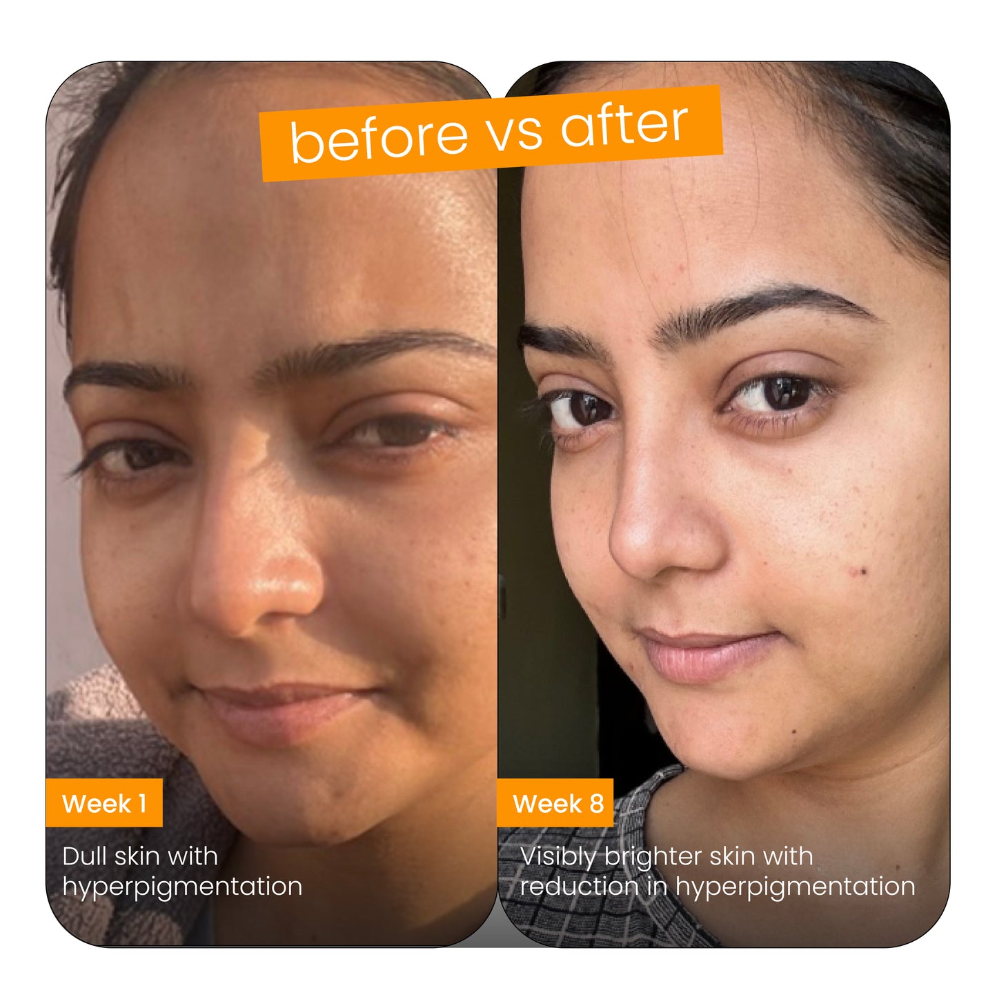Super booster brightening serum