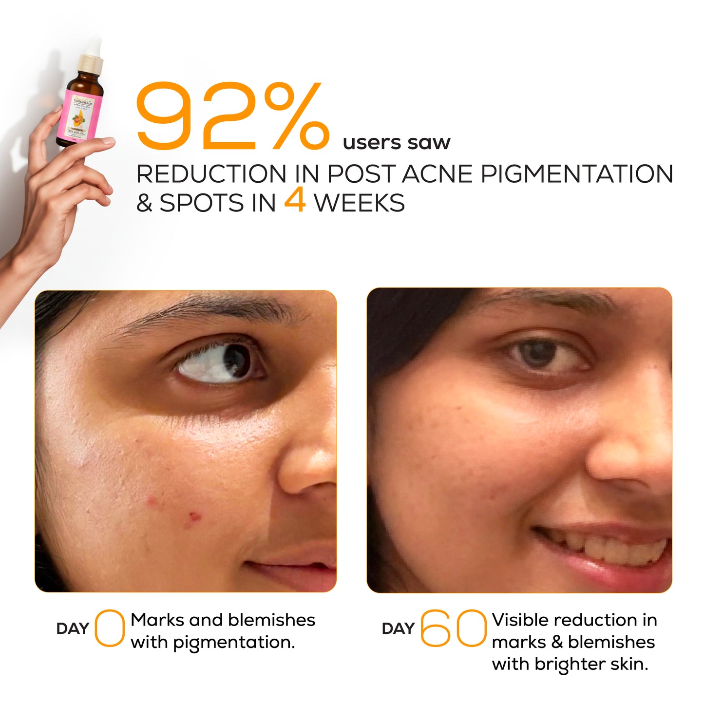 Marks & blemish reduction serum