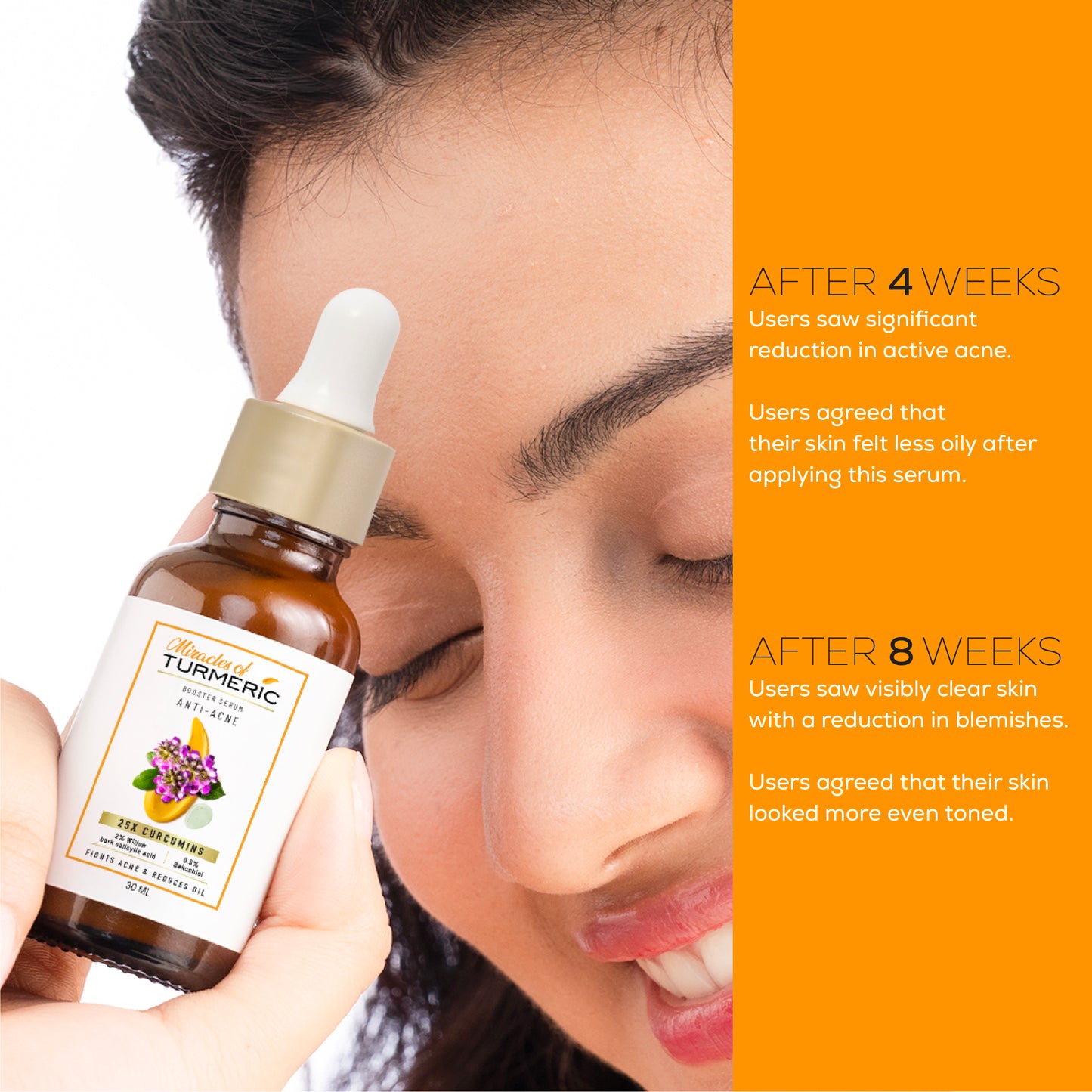 Anti-Acne clarifying serum