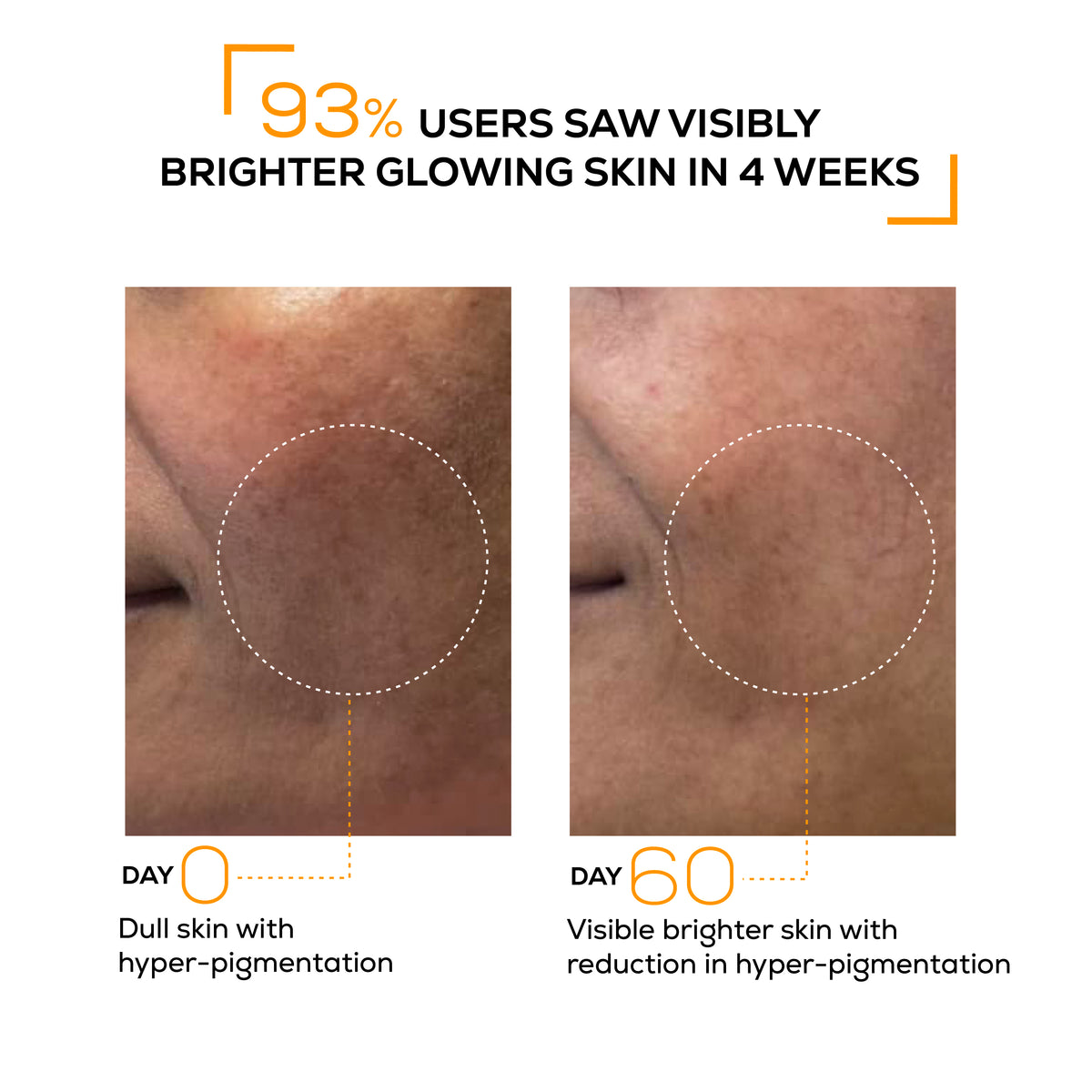 Pigmentation Reduction Serum