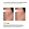 Pigmentation Reduction Serum