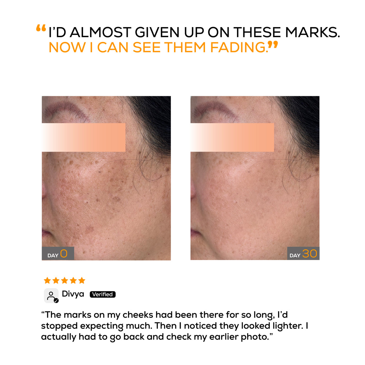 Pigmentation Reduction Serum